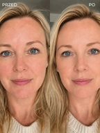 Rivea Changing Foundation